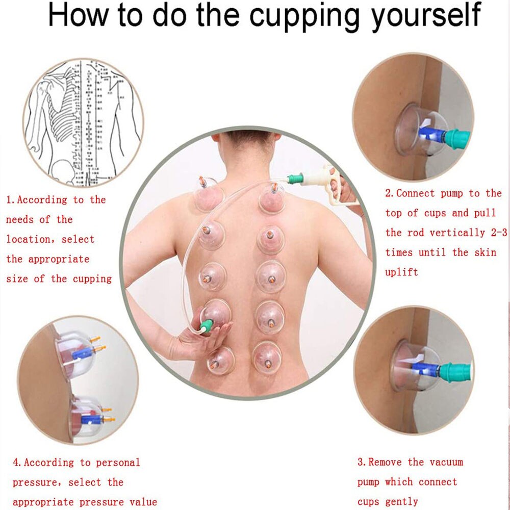 Effektiv Cupping Terapi Sæt - Lindring og Velvære i Hjemmet