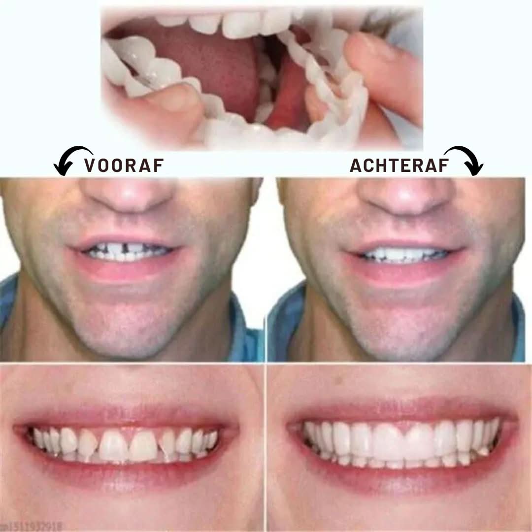 Justerbare Tandskaller til en Strålende Smil