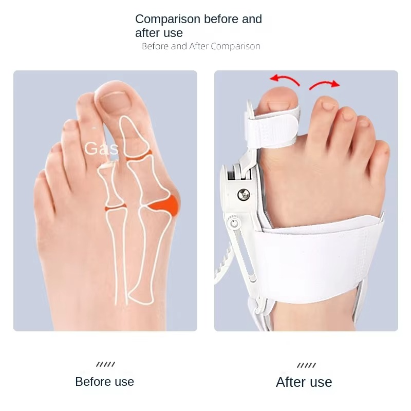 FlexiStep - Lindrer fodsmerter for lette og livsglade dage