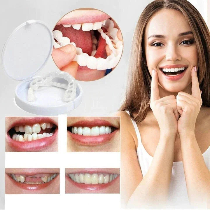 Omedelbart användbara Smile Veneers för ett Snyggt Leende