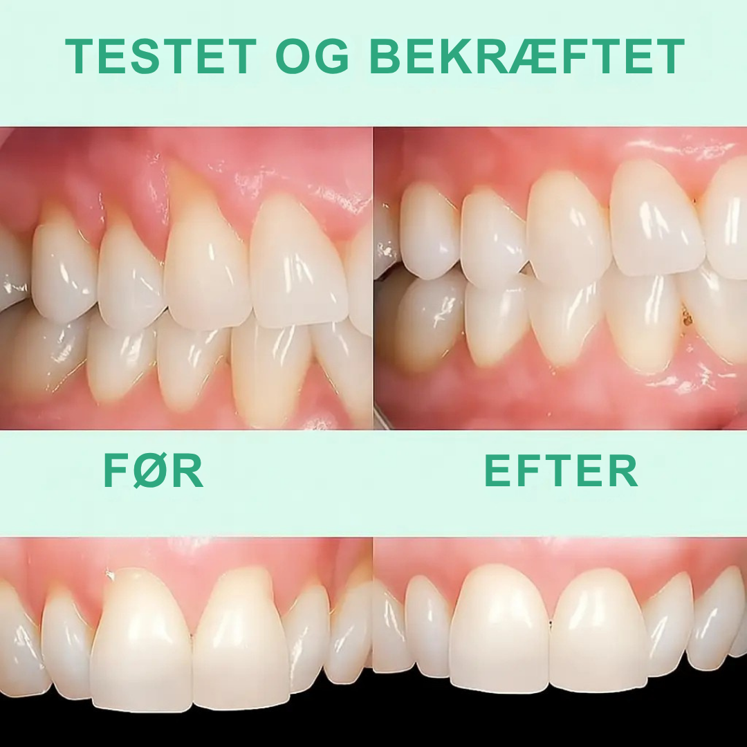 Naturlig Tandkødspleje med Urteekstrakter for Sundt Smil