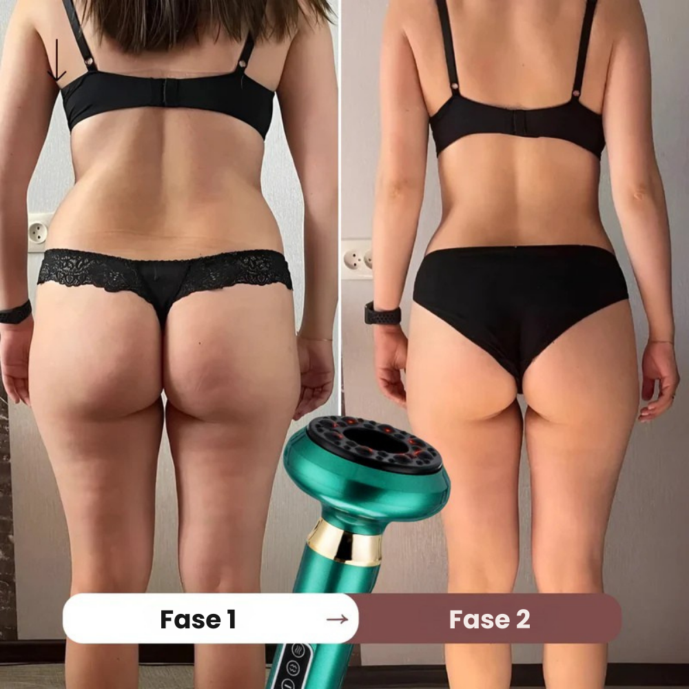 Effektiv Anti-Cellulitmassage – Slät och Spänstig Hud Hemma
