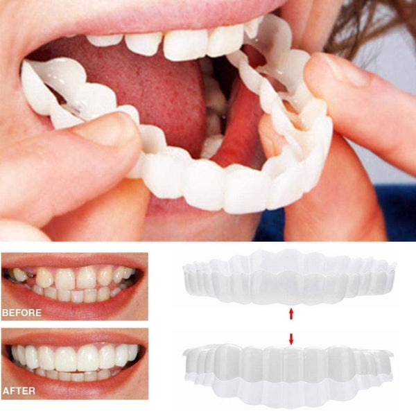 Strålande Smile Veneers för en perfekt tandrad