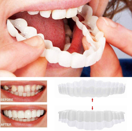 Strålande Smile Veneers för en perfekt tandrad