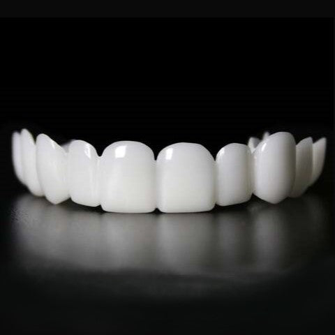 Omedelbart användbara Smile Veneers för ett Snyggt Leende