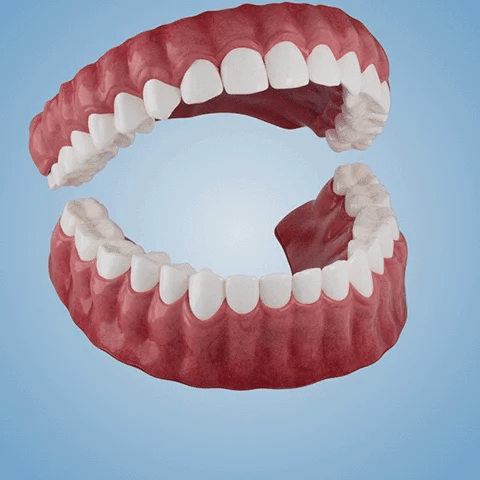 SmileFitPro – Ny Generation: Flexibel Helprotes