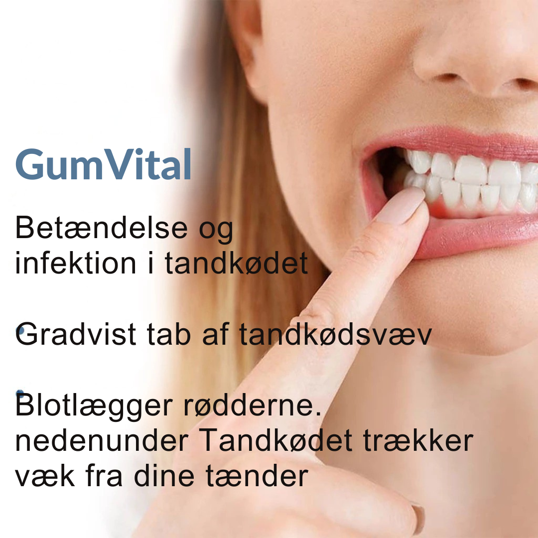 Naturlig Tandkødspleje med Urteekstrakter for Sundt Smil