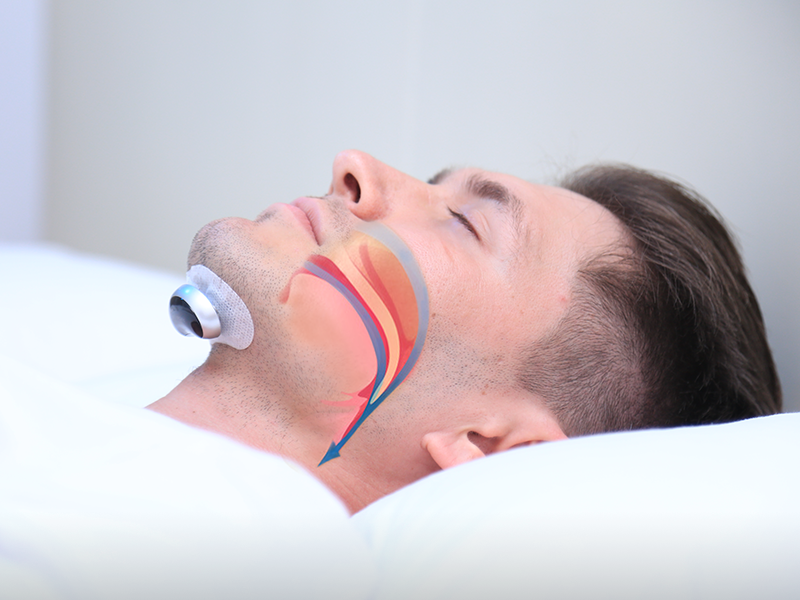 Komfortabel Snorken Stopper – QuietWave