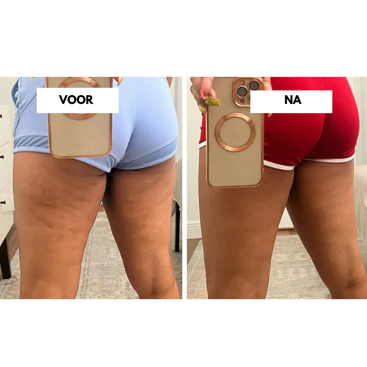 Effektiv vakuummassager til reduktion af cellulite