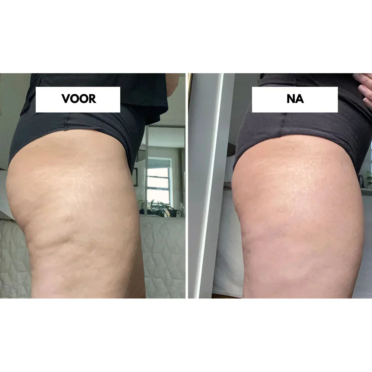 Effektiv vakuummassager til reduktion af cellulite