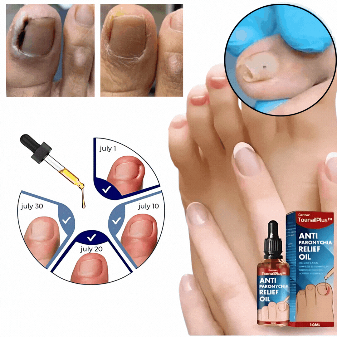 Negleolie til irriterede neglebånd | Indeholder nelkeolie, E-vitamin & sheasmør | 10 ml
