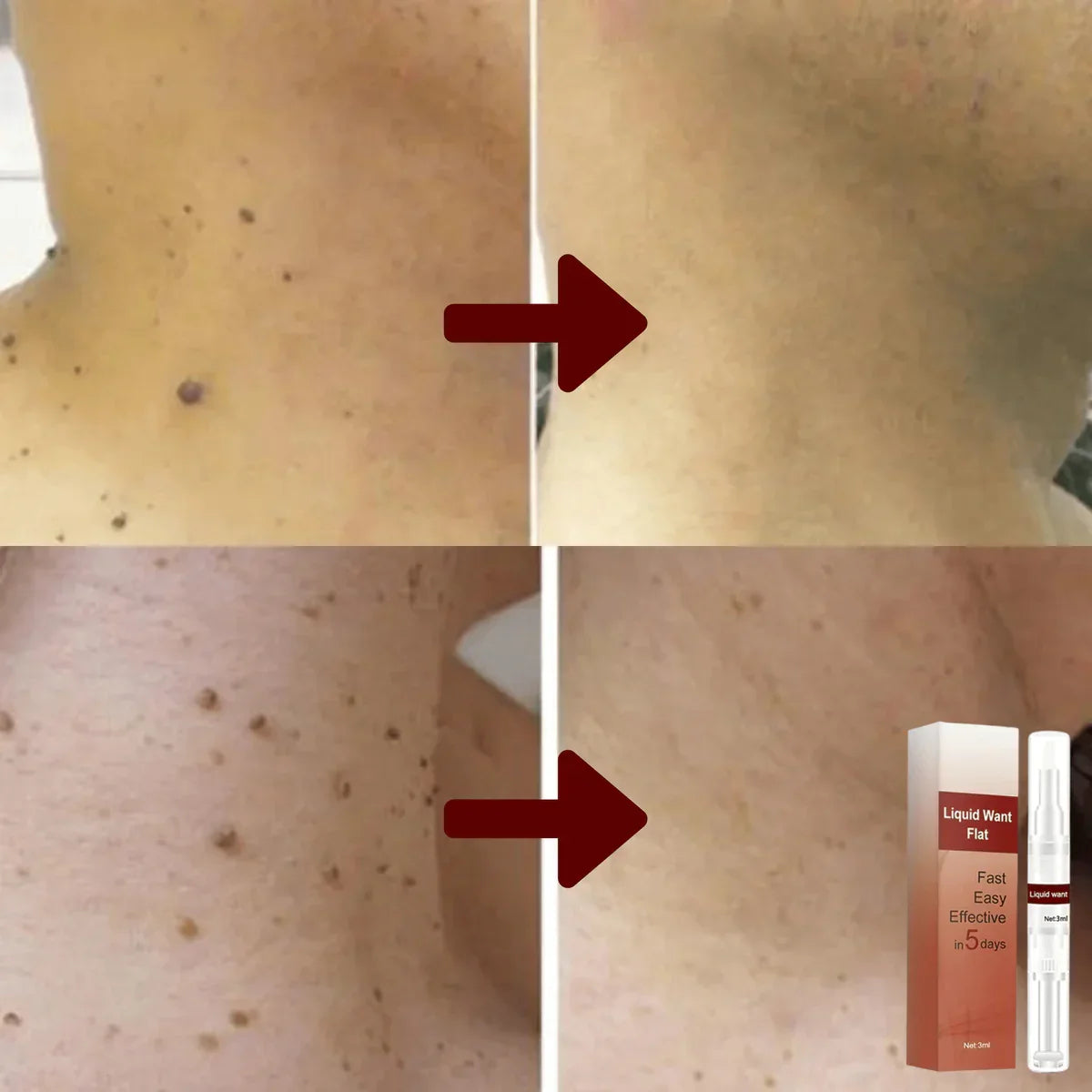Hudserum med Tea Tree Oil och örtextrakt, 3 ml – För ansikte och kropp