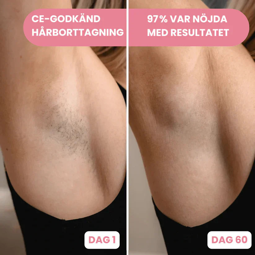 Effektiv IPL Hårfjerning derhjemme | Smertefri & Langvarig