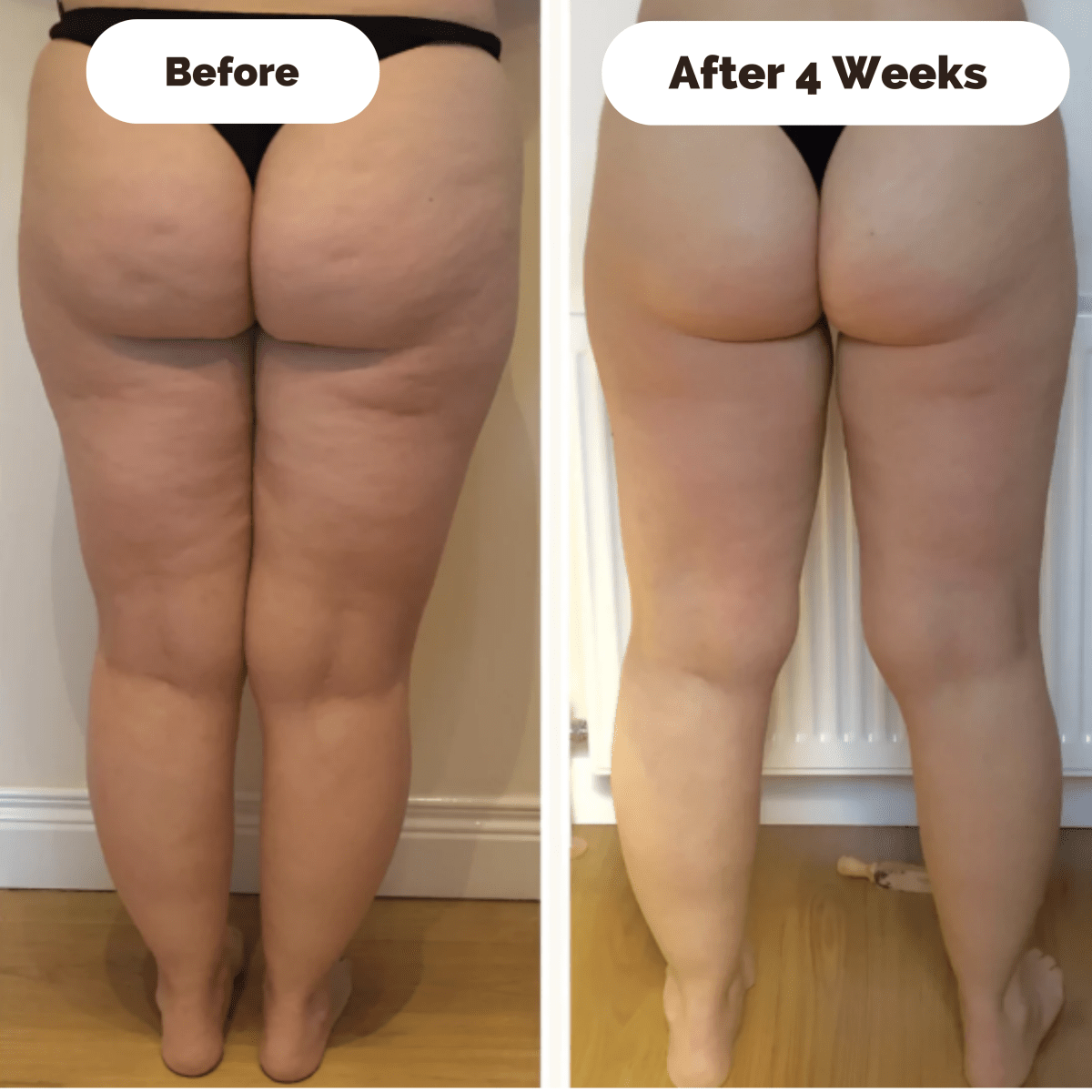Effektiv Anti-Cellulite Massager med Justerbar Intensitet