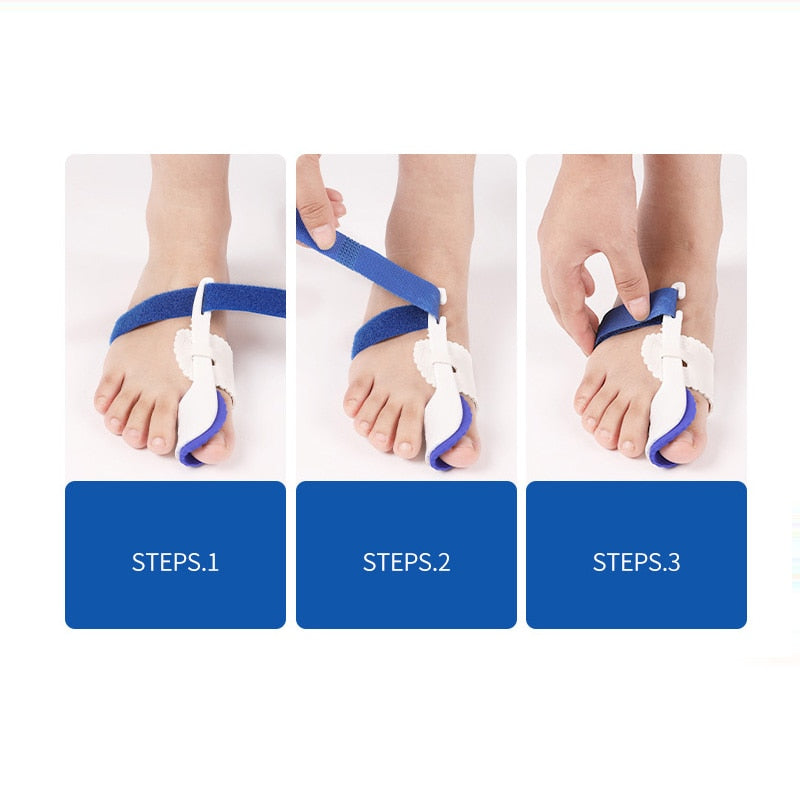 Effektiv nattkena för Hallux Valgus-korrigering