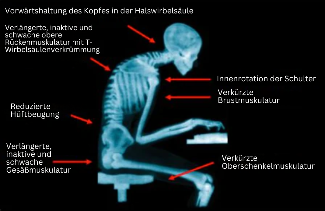 EMS Håndledsband til Kropsholdning