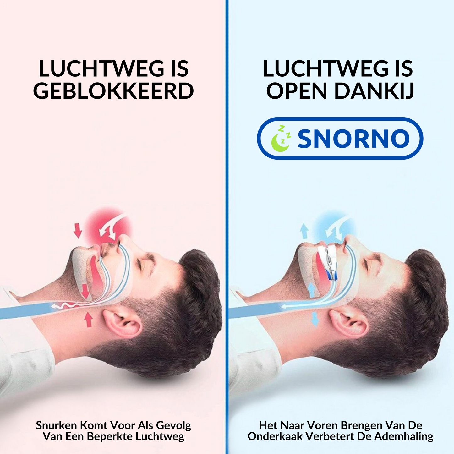 Søvnvenlig Beugel til Ronkefri Nætter