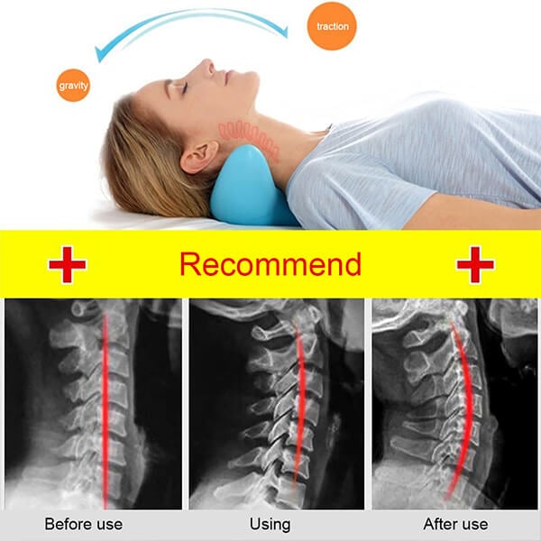Ergonomisk nakkemassagepude uden elektricitet – Nakkestræk