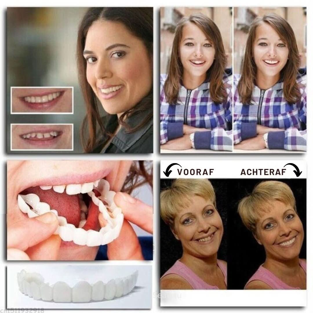 Justerbare Tandskaller til en Strålende Smil