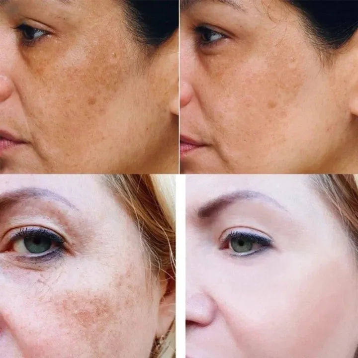 Naturligt A-serum för att ljusa upp mörka fläckar