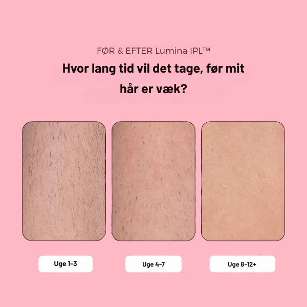 Effektiv IPL Hårfjerning derhjemme | Smertefri & Langvarig